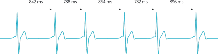  Herzratenvariabilität (HRV)